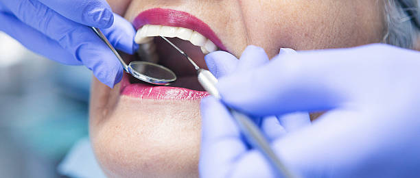 Best Emergency Dental Care for Broken or Chipped Teeth in Fulton, KY